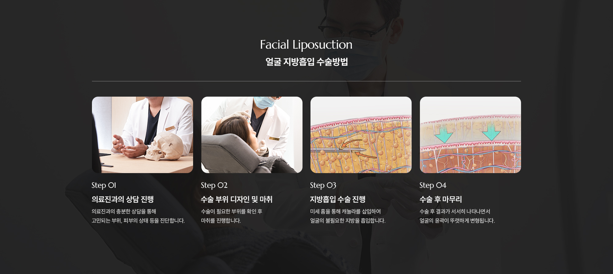 [얼굴 지방흡입 수술방법] Step 01 : 의료진과의 상담 진행 / Step 02 : 시술 부위 디자인 및 마취 / Step 03 : 지방흡입 시술 진행 / Step 04 : 시술 후 마무리