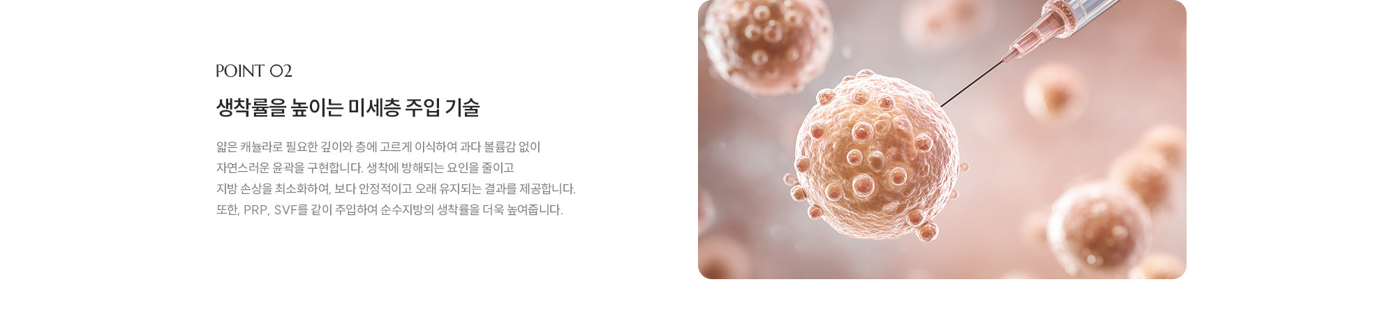 [POINT 02] 생착률을 높이는 미세층 주입 기술 : 얇은 캐뉼라로 필요한 깊이와 층에 고르게 이식하여 과다 볼륨감 없이 자연스러운 윤곽을 구현합니다. 생착에 방해되는 요인을 줄이고 지방 손상을 최소화하여, 보다 안정적이고 오래 유지되는 결과를 제공합니다. 또한, PRP, SVF를 같이 주입하여 순수지방의 생착률을 더욱 높여줍니다.