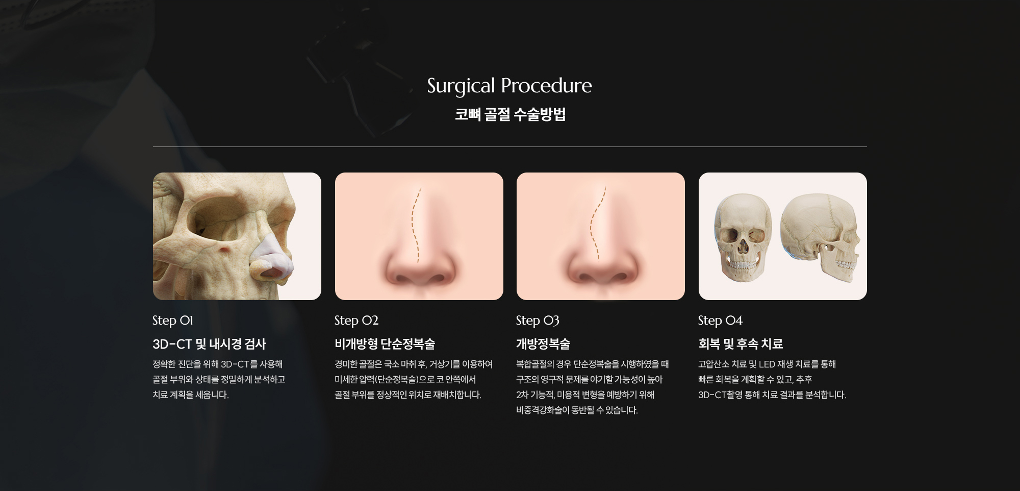[코뼈 골절 수술방법] Step 01 : 3D-CT 및 내시경 검사  /  Step 02 : 비개방형 단순정복술  /  Step 03 : 개방정복술  /  Step 04 : 회복 및 후속 치료