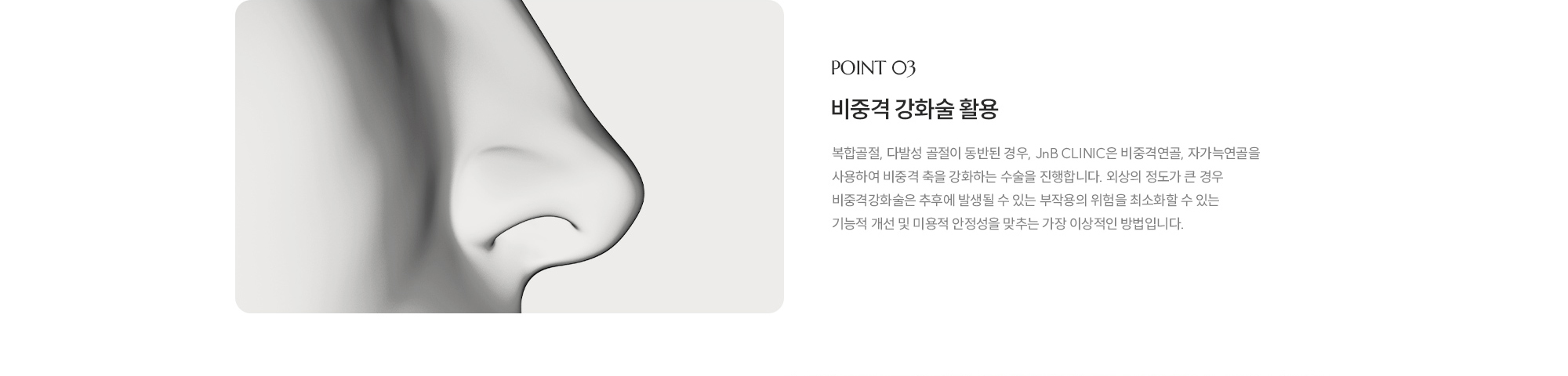 [POINT 03] 비중격 강화술 활용 : 복합골절, 다발성 골절이 동반된 경우, JnB CLINIC은 비중격연골, 자가늑연골을 사용하여 비중격 축을 강화하는 수술을 진행합니다. 외상의 정도가 큰 경우 비중격강화술은 추후에 발생될 수 있는 부작용의 위험을 최소화할 수 있는 기능적 개선 및 미용적 안정성을 맞추는 가장 이상적인 방법입니다.