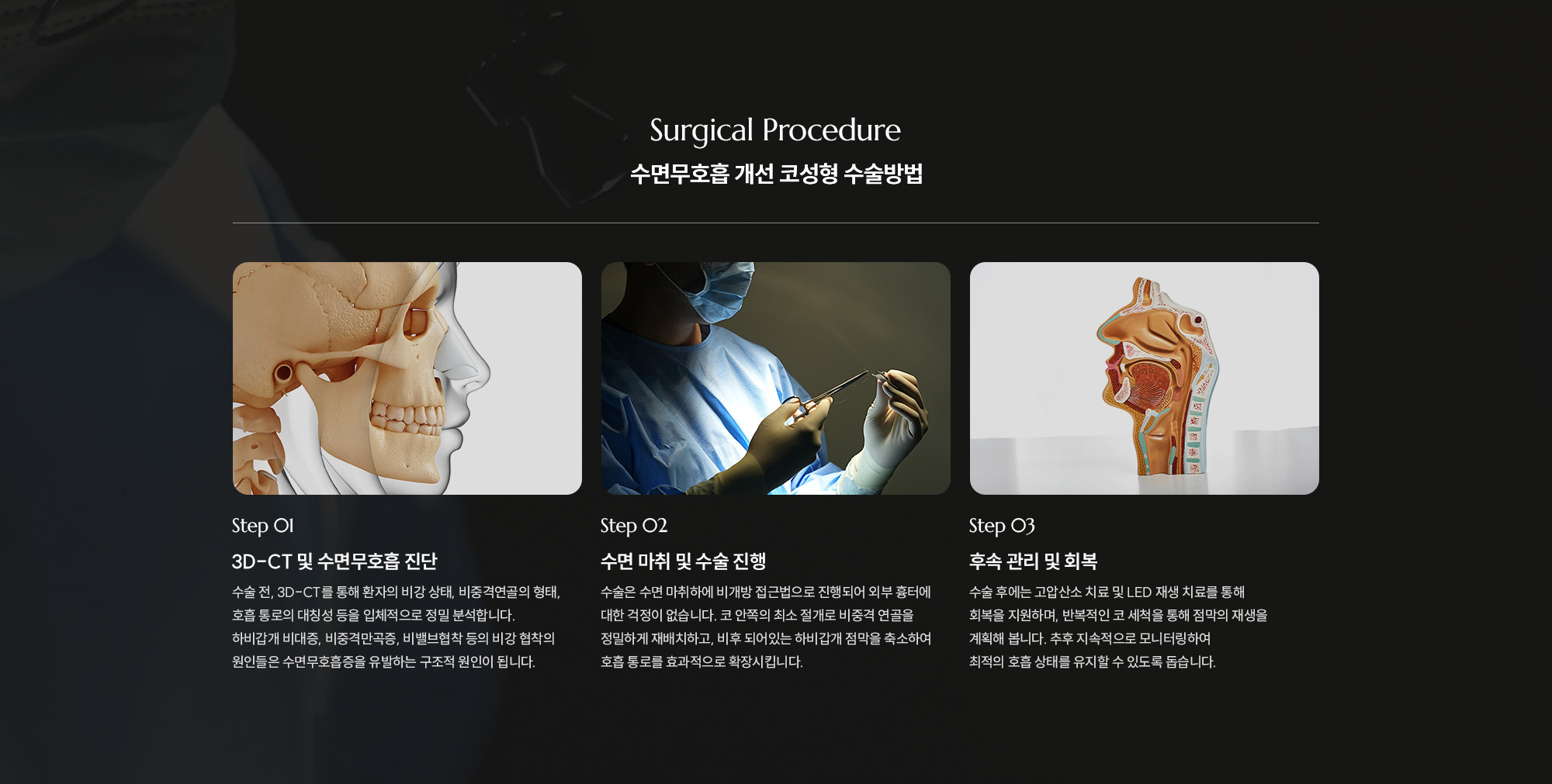[수면무호흡 개선 코성형 수술방법] Step 01 : 3D-CT 및 수면무호흡 진단  /  Step 02 : 수면 마취 및 수술 진행  /  Step 03 : 후속 관리 및 회복