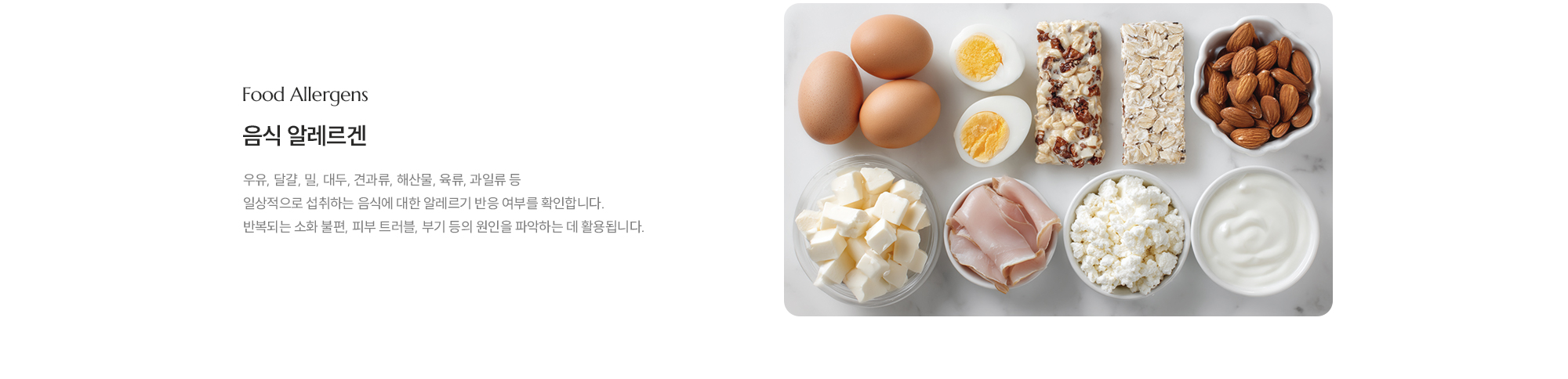[Food Allergens] [음식 알레르겐] 우유, 달걀, 밀, 대두, 견과류, 해산물, 육류, 과일류 등 일상적으로 섭취하는 음식에 대한 알레르기 반응 여부를 확인합니다. 반복되는 소화 불편, 피부 트러블, 부기 등의 원인을 파악하는 데 활용됩니다.