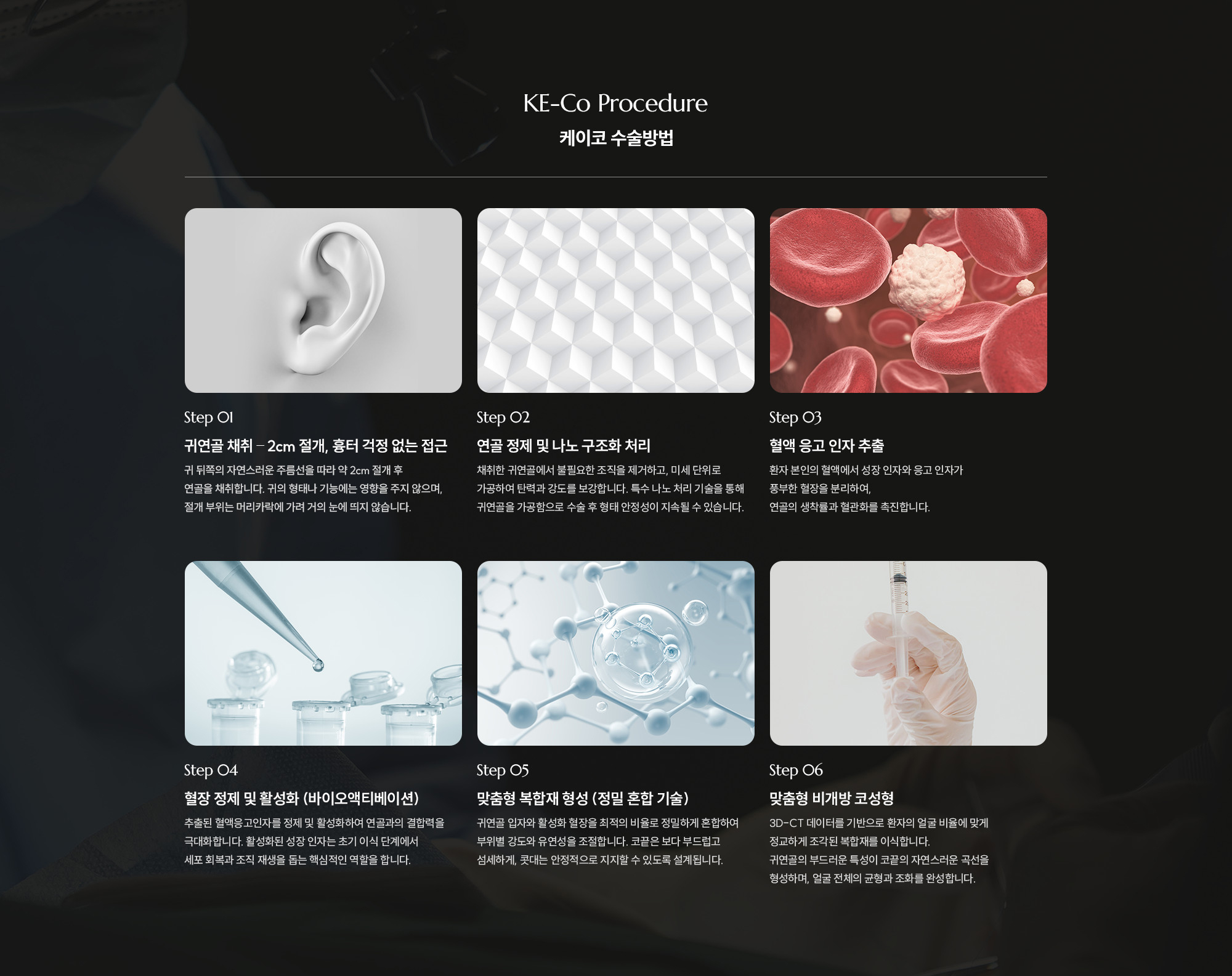[제이코 수술방법] Step 01 - 귀연골 채취 - 2cm 절개, 흉터 걱정 없는 접근 / Step 02 - 연골 정제 및 나노 구조화 처리 / Step 03 - 혈액 응고 인자 추출 / Step 04 - 혈장 정제 및 활성화 (바이오액티베이션) / Step 05 - 맞춤형 복합재 형성 (정밀 혼합 기술) / Step 06 - 맞춤형 비개방 코성형