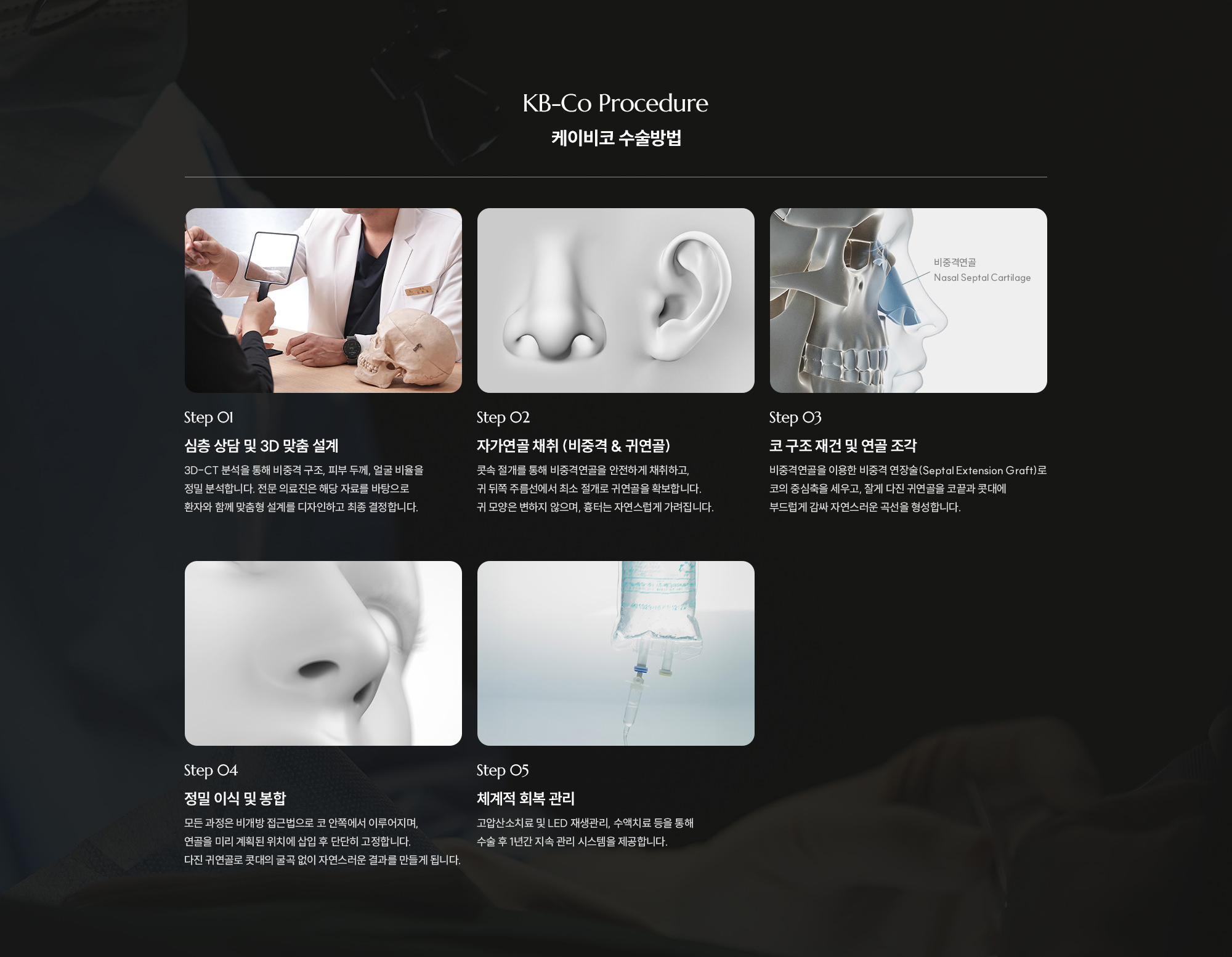 [제이비코 수술방법] Step 01 : 심층 상담 및 3D 맞춤 설계 / Step 02 : 자가연골 채취 (비중격 & 귀연골) / Step 03 : 코 구조 재건 및 연골 조각 / Step 04 : 정밀 이식 및 봉합 / Step 05 : 체계적 회복 관리