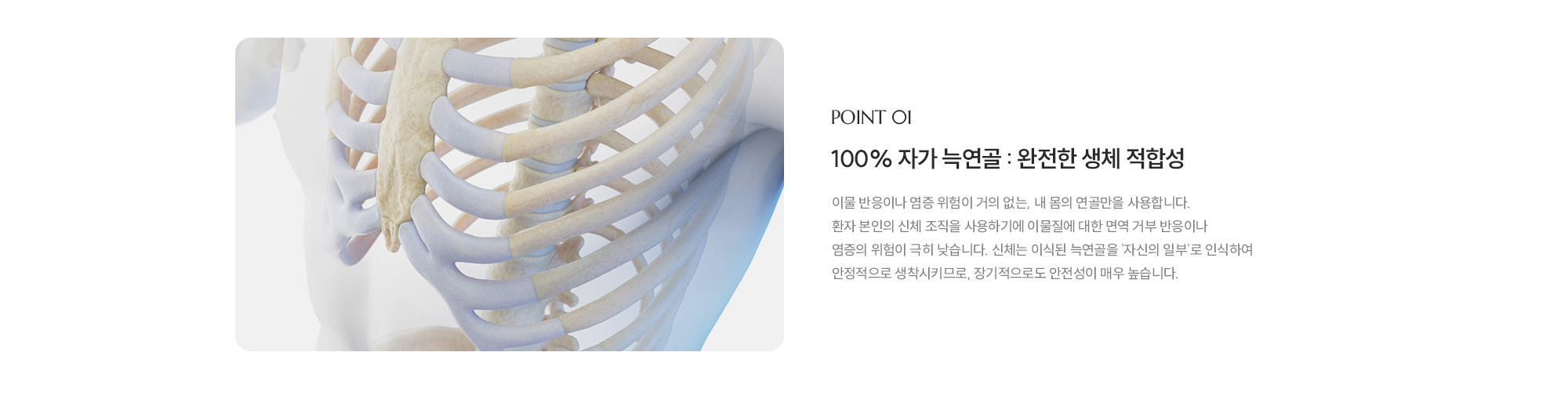 [POINT 01] 100% 자가 늑연골 : 완전한 생체 적합성 : 이물 반응이나 염증 위험이 거의 없는, 내 몸의 연골만을 사용합니다. 환자 본인의 신체 조직을 사용하기에 이물질에 대한 면역 거부 반응이나 염증의 위험이 극히 낮습니다. 신체는 이식된 늑연골을 '자신의 일부'로 인식하여 안정적으로 생착시키므로, 장기적으로도 안전성이 매우 높습니다.