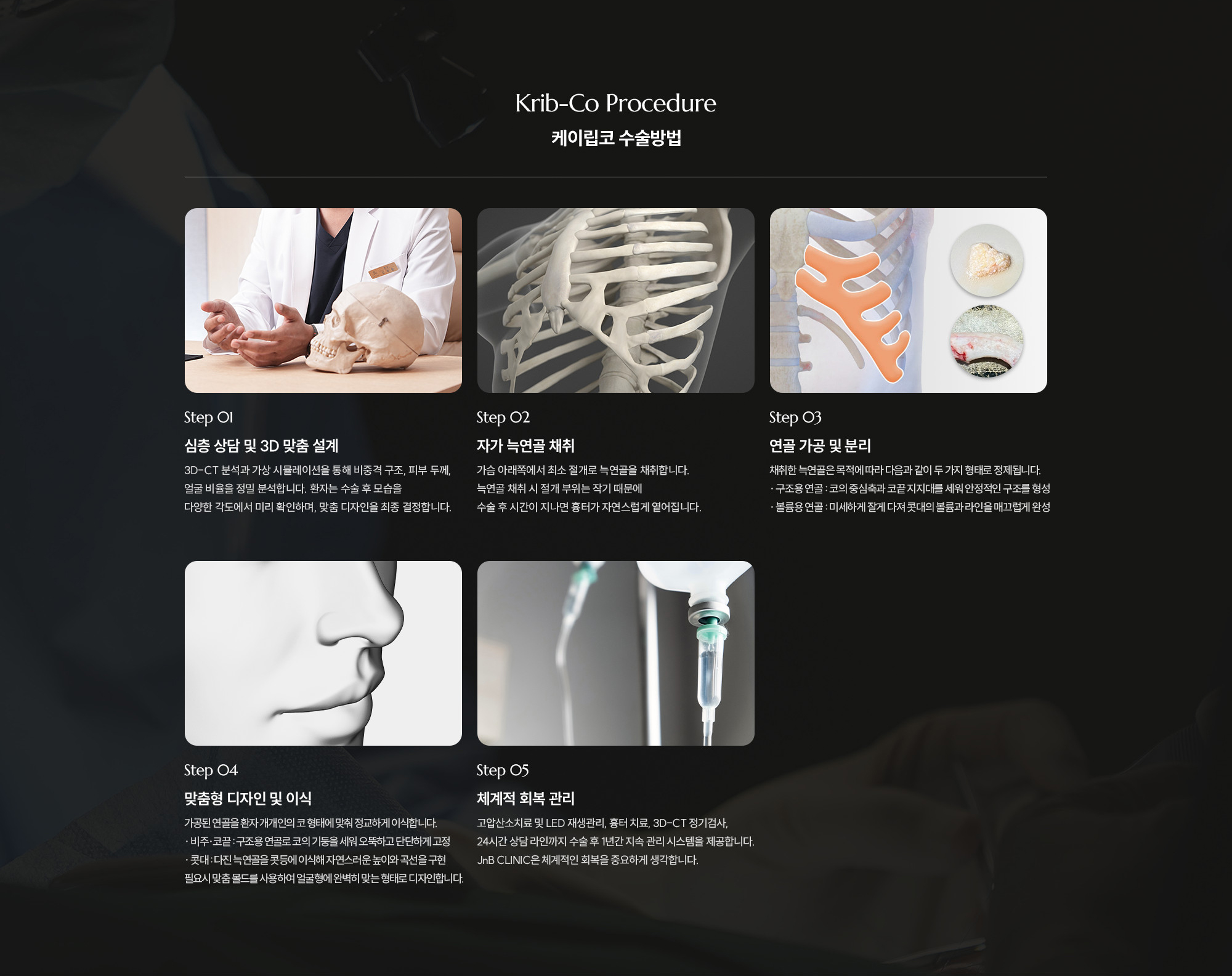 [제이립코 수술방법] Step 01 : 심층 상담 및 3D 맞춤 설계 / Step 02 : 자가 늑연골 채취 / Step 03 : 연골 가공 및 분리 / Step 04 : 맞춤형 디자인 및 이식 / Step 05 : 체계적 회복 관리
