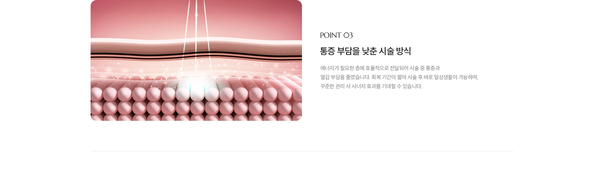 [POINT 03] [통증 부담을 낮춘 시술 방식] 에너지가 필요한 층에 효율적으로 전달되어 시술 중 통증과 열감 부담을 줄였습니다. 회복 기간이 짧아 시술 후 바로 일상생활이 가능하며, 꾸준한 관리 시 시너지 효과를 기대할 수 있습니다.