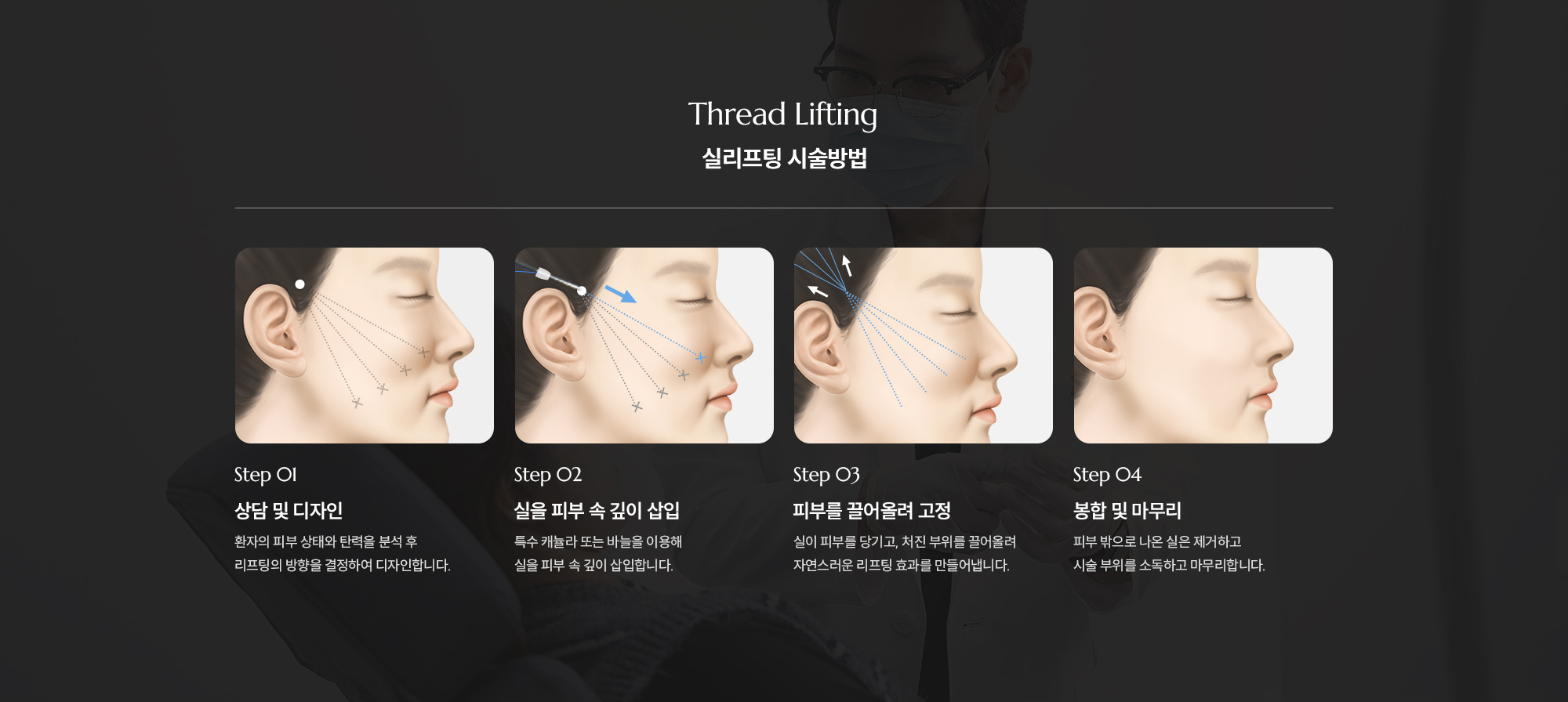 [실리프팅 시술방법] Step 01 : 상담 및 디자인  /  Step 02 : 실을 피부 속 깊이 삽입  /  Step 03 : 피부를 끌어올려 고정  /  Step 04 : 봉합 및 마무리