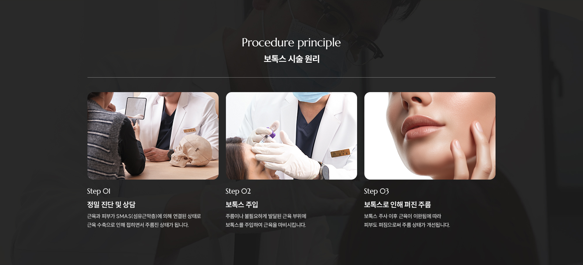[보톡스 시술 원리] Step 01 : 정밀 진단 및 상담  /  Step 02 : 보톡스 주입  /  Step 03 : 보톡스로 인해 펴진 주름