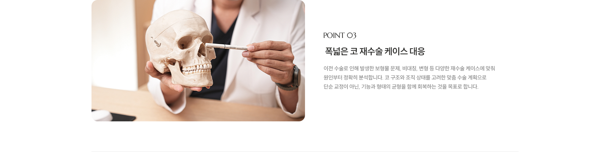 [POINT 03] 폭넓은 코 재수술 케이스 대응 : 이전 수술로 인해 발생한 보형물 문제, 비대칭, 변형 등 다양한 재수술 케이스에 맞춰 원인부터 정확히 분석합니다. 코 구조와 조직 상태를 고려한 맞춤 수술 계획으로 단순 교정이 아닌, 기능과 형태의 균형을 함께 회복하는 것을 목표로 합니다.