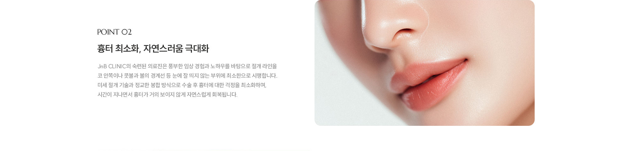 [POINT 02] 흉터 최소화, 자연스러움 극대화 : JnB CLINIC의 숙련된 의료진은 풍부한 임상 경험과 노하우를 바탕으로 절개 라인을 코 안쪽이나 콧볼과 볼의 경계선 등 눈에 잘 띄지 않는 부위에 최소한으로 시행합니다. 미세 절개 기술과 정교한 봉합 방식으로 수술 후 흉터에 대한 걱정을 최소화하며, 시간이 지나면서 흉터가 거의 보이지 않게 자연스럽게 회복됩니다.