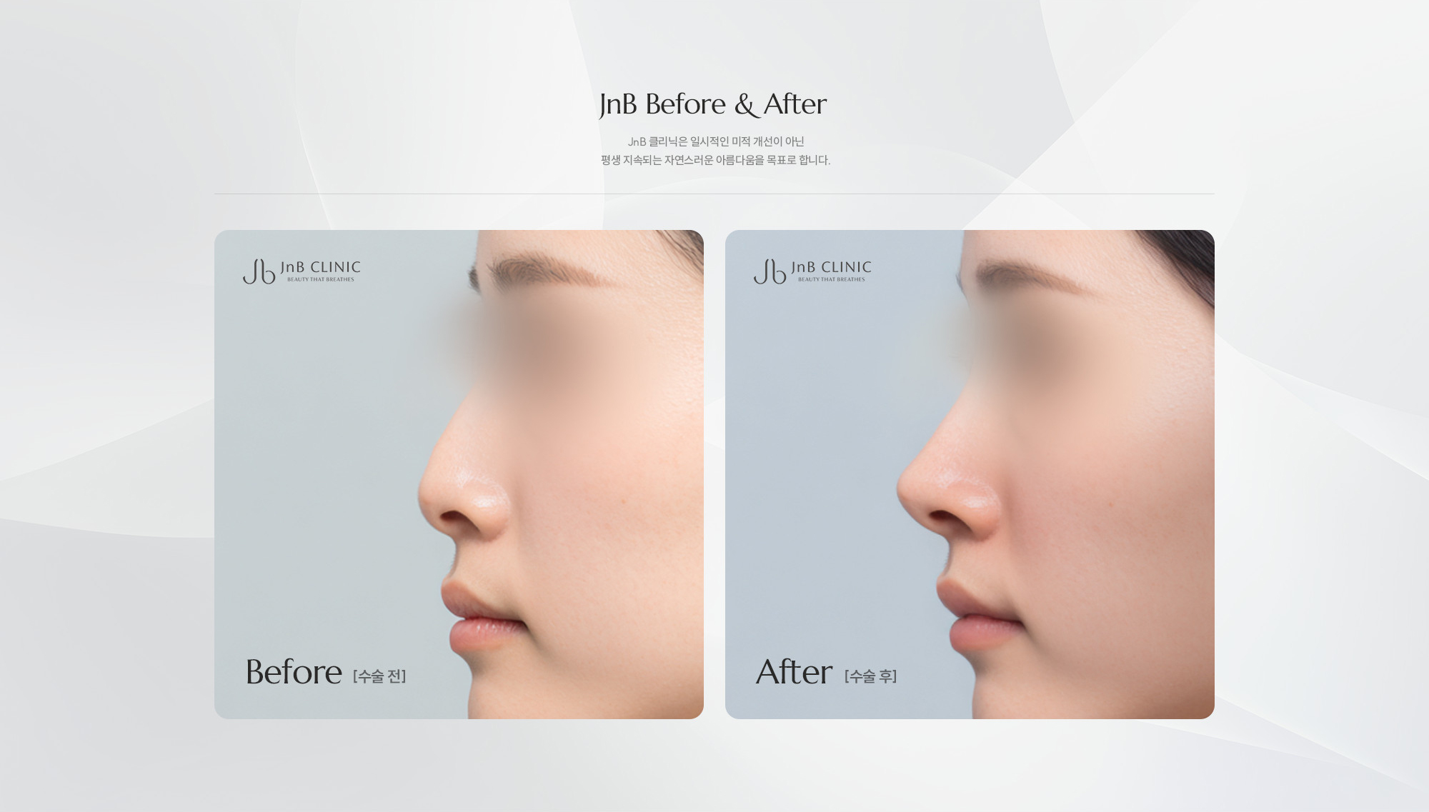 [JnB Before & After] JnB 클리닉은 일시적인 미적 개선이 아닌 평생 지속되는 자연스러운 아름다움을 목표로 합니다.