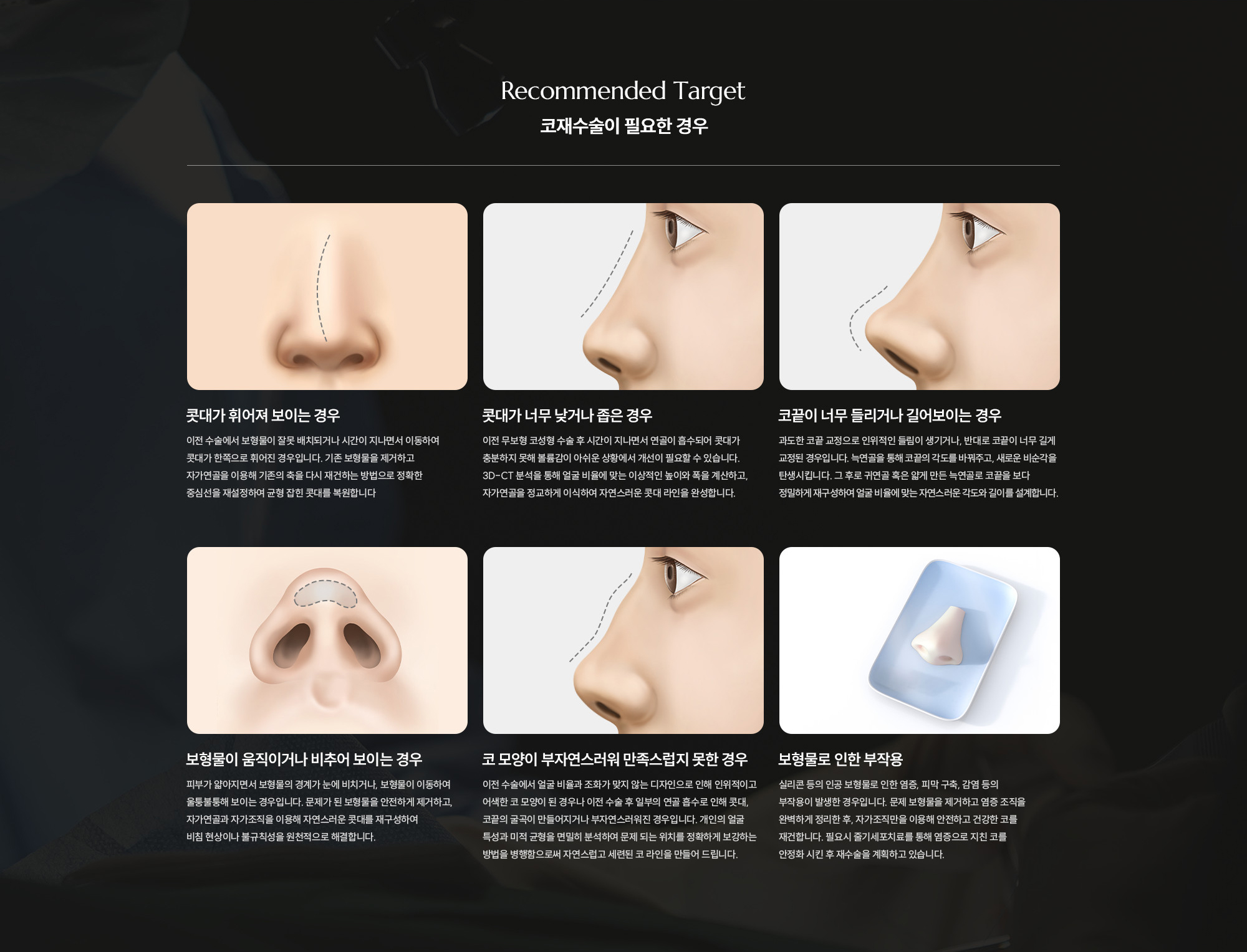 [코재수술이 필요한 경우] 콧대가 휘어져 보이는 경우 / 콧대가 너무 낮거나 좁은 경우 / 코끝이 너무 들리거나 길어보이는 경우 / 보형물이 움직이거나 비추어 보이는 경우 / 코 모양이 부자연스러워 만족스럽지 못한 경우 / 보형물로 인한 부작용