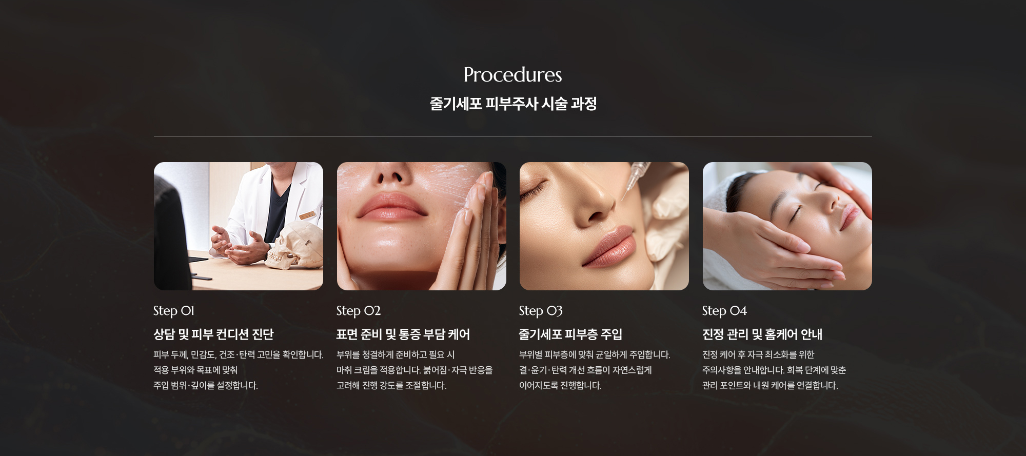 [줄기세포 피부주사 시술 과정] Step 01 : 상담 및 피부 컨디션 진단  /  Step 02 : 표면 준비 및 통증 부담 케어  /  Step 03 : 줄기세포 피부층 주입  /  Step 04 : 진정 관리 및 홈케어 안내